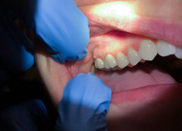 Best Tooth Pain Emergency Relief  in Medina, WA