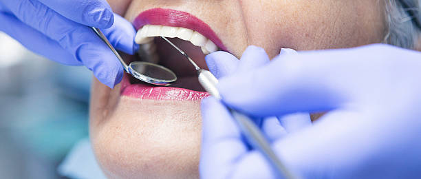 Best Broken Tooth Emergency  in Medina, WA